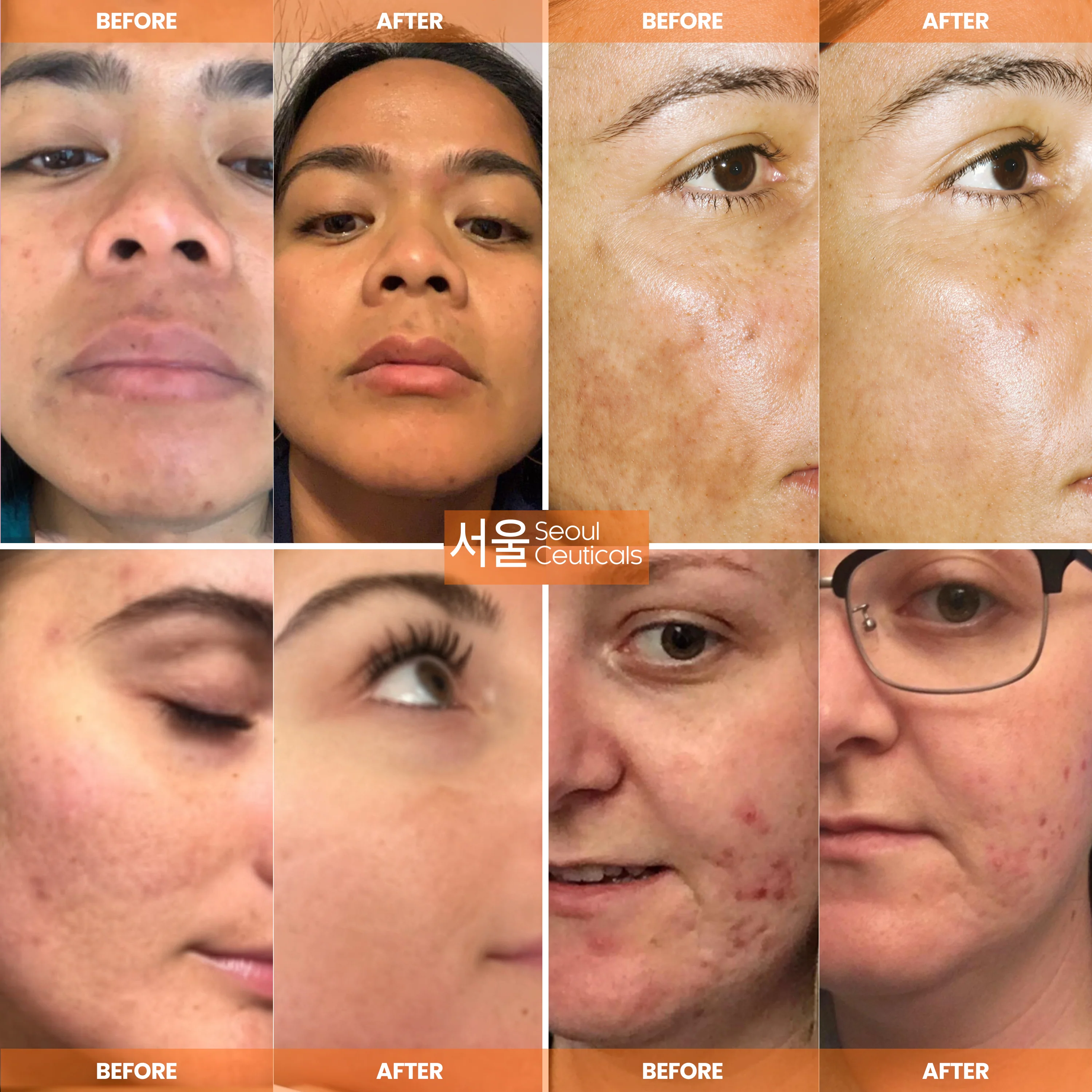 All-in-One K Beauty 5-Step Routine - Image 3