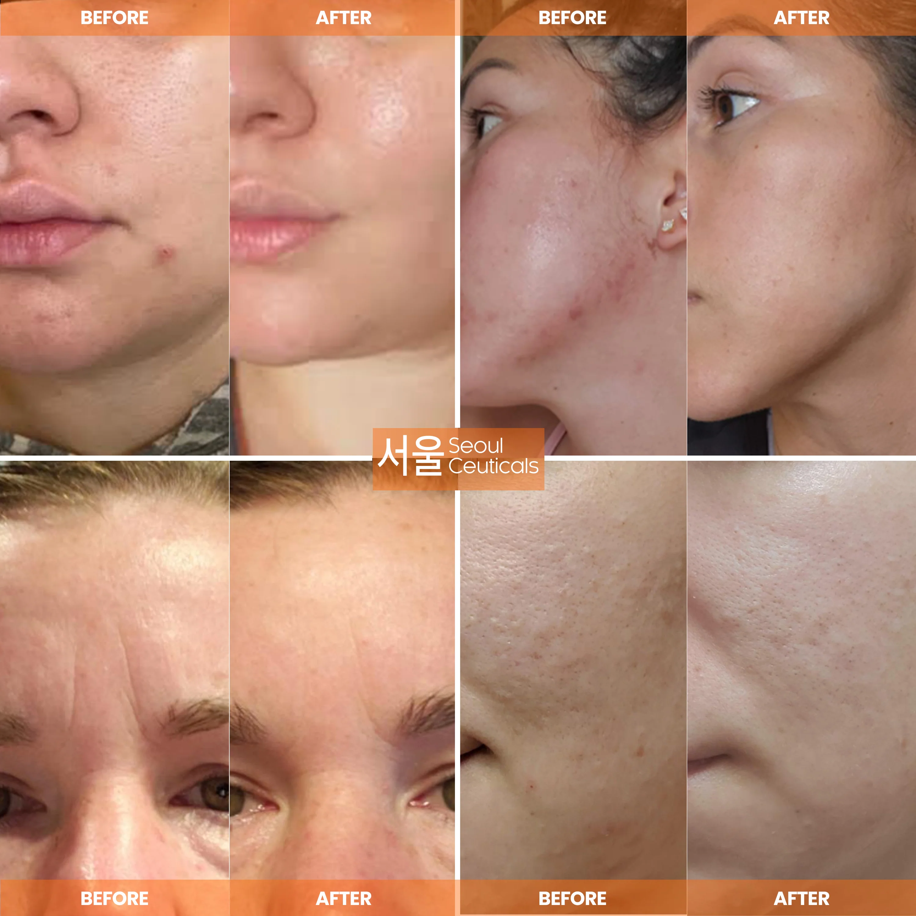 Snail Repair Cream Moisturizer - Image 4